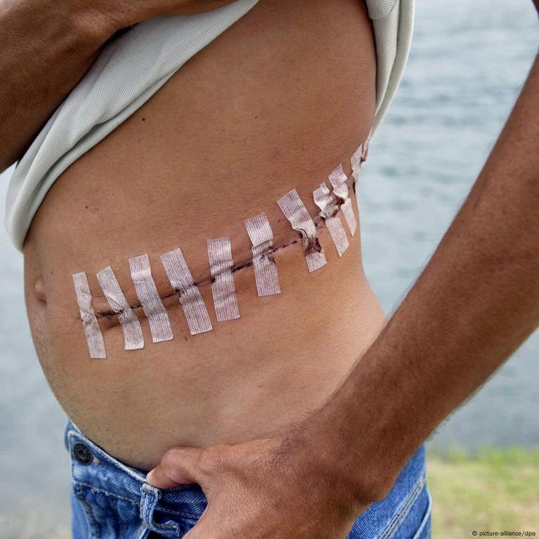 Unveiling the Dark Underbelly: The Reality of Illegal Organ Trafficking in U.S. Cities