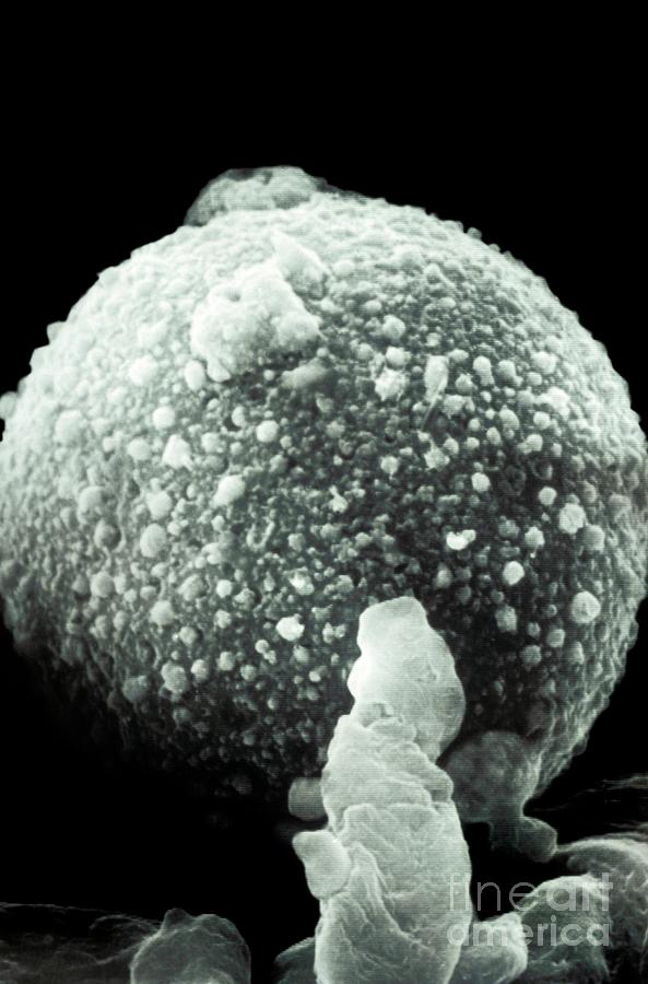 Silent Witnesses: Tracing a Body's Last Journey Through Pollen and Spores