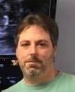 Mickey Dixon death by force case profile photo