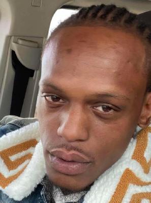 Dennis Durley death by force case profile photo