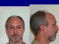 Ralph Belvedere missing person case profile photo