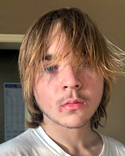 Dylan Fitzgibbon missing person case profile photo