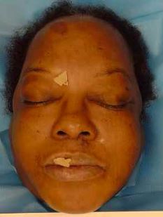 Sharon McKeiver - Arverne, New York