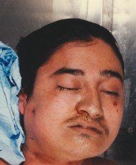 John Doe — East Rancho Dominguez, California - unidentified case UP3480